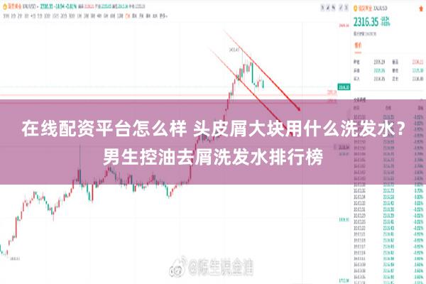 在线配资平台怎么样 头皮屑大块用什么洗发水？男生控油去屑洗发水排行榜